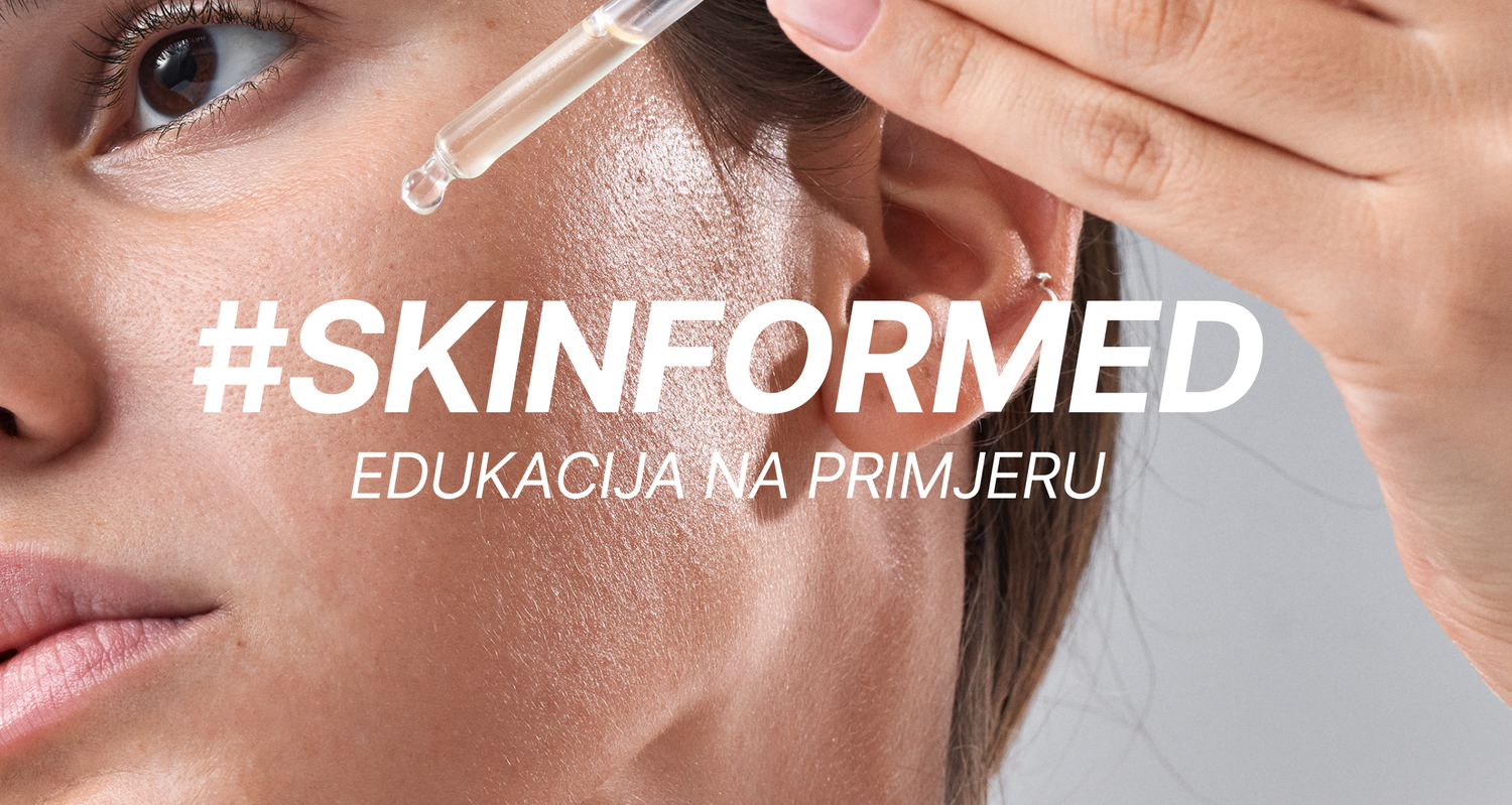 #SKINFORMIERT / Hormonell bedingte Hyperpigmentierung