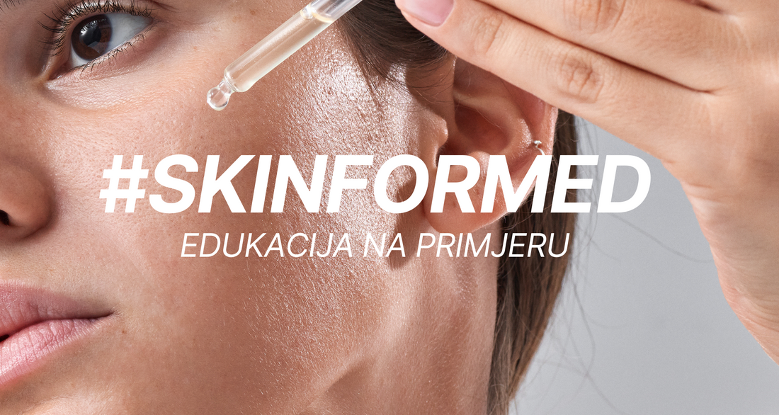 #SKINFORMED / Razlika između komedona i sebacealnih nakupina